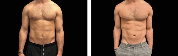 Better Abs, Bigger Glutes! 11am-2pm Daily! (East Hollywood)