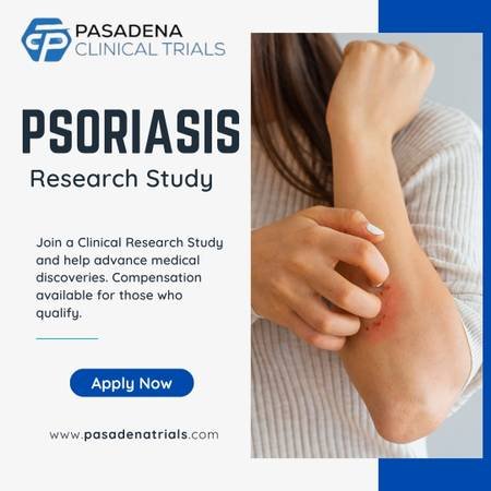 Earn Money for Paid Participation in a Psoriasis Clinical Study in Pasadena